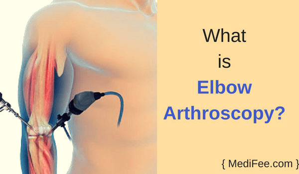 what is elbow arthroscopy what is elbow arthroscopy