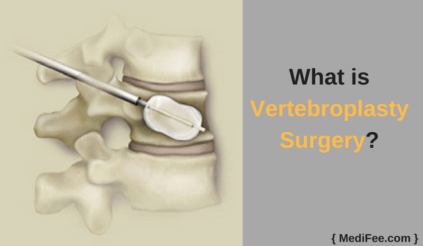 what is vertebroplasty