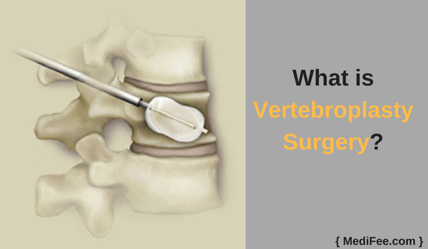 what is vertebroplasty what is vertebroplasty
