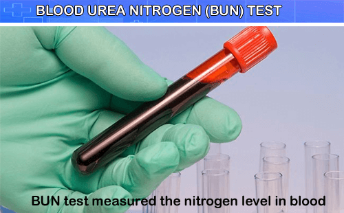 What are blood urea nitrogen tests?