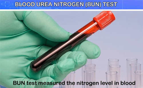 test urea blood of Online Test Book (BUN) Urea Nitrogen Blood