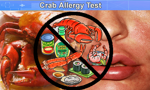 Image result for Crab Allergy