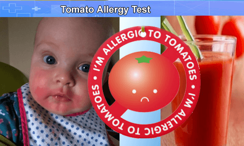 Image result for tomato allergy